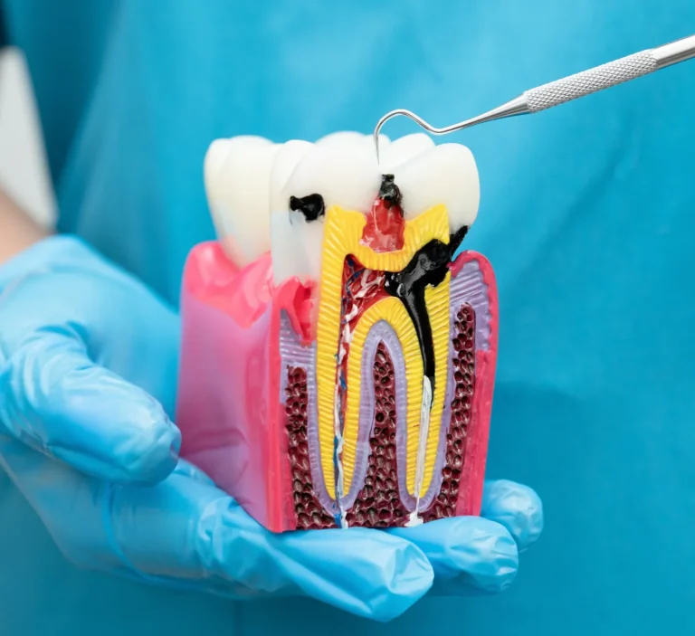 Dental procedure demonstration model