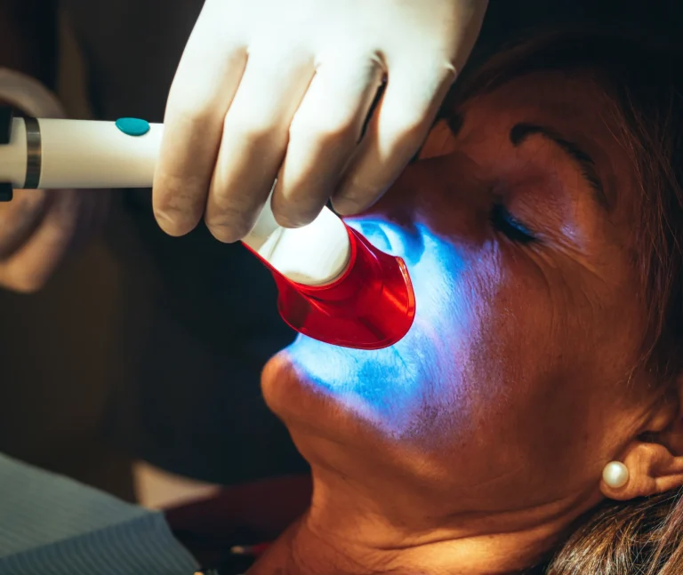 Fluoride treatment dental procedure