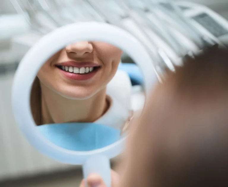 Professional teeth whitening outcome