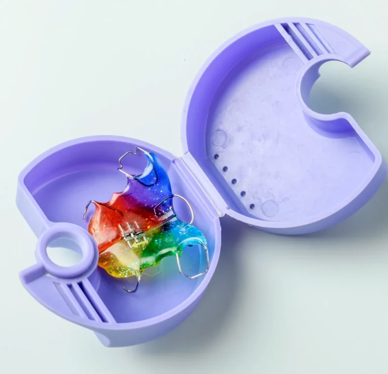 Custom retainer appliance set