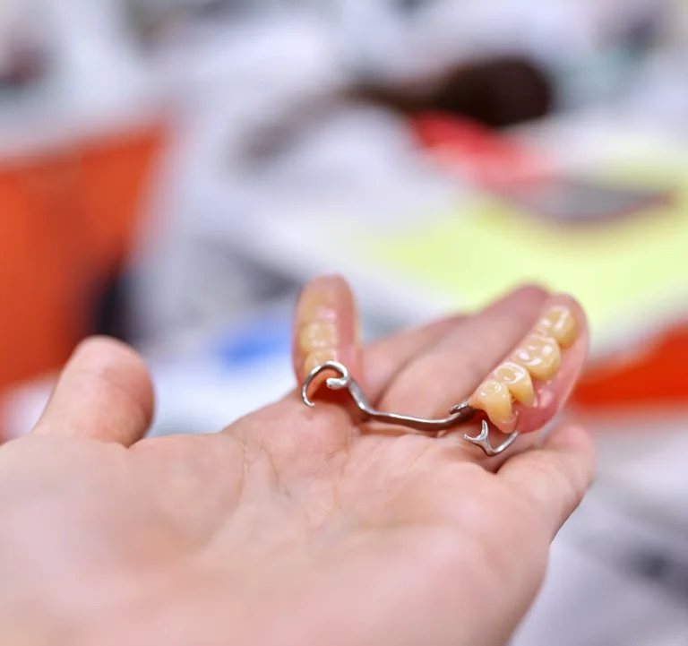Dental prosthetic restoration option