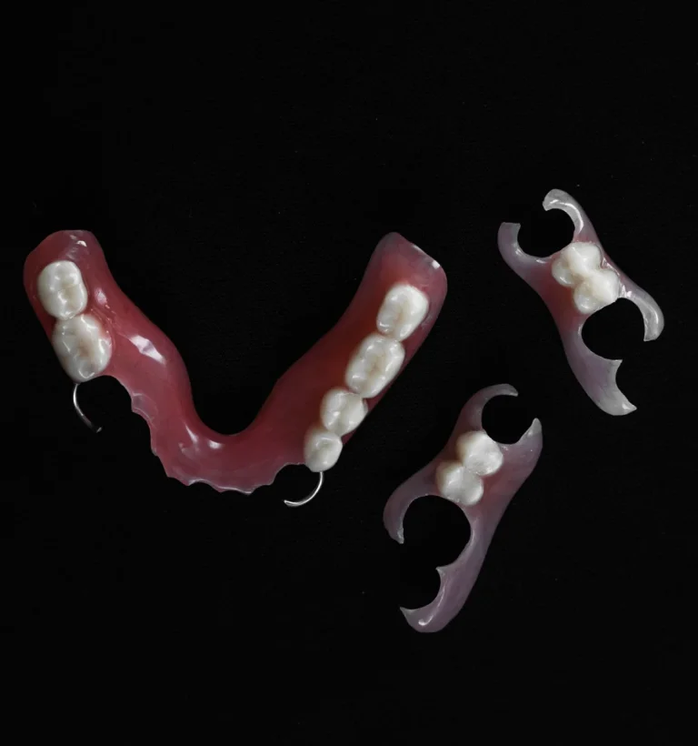 Dental prosthetic restoration option