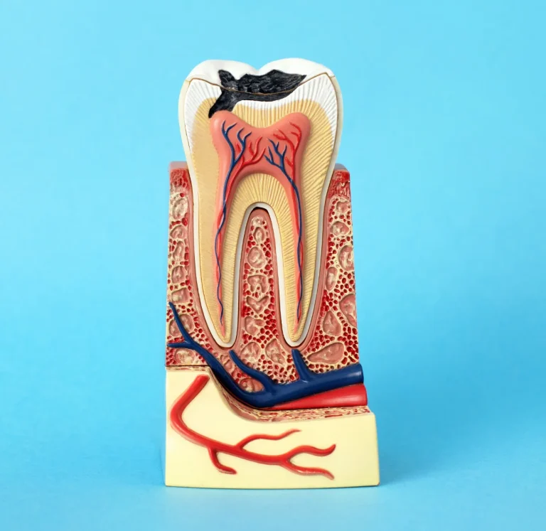 Endodontic treatment illustration