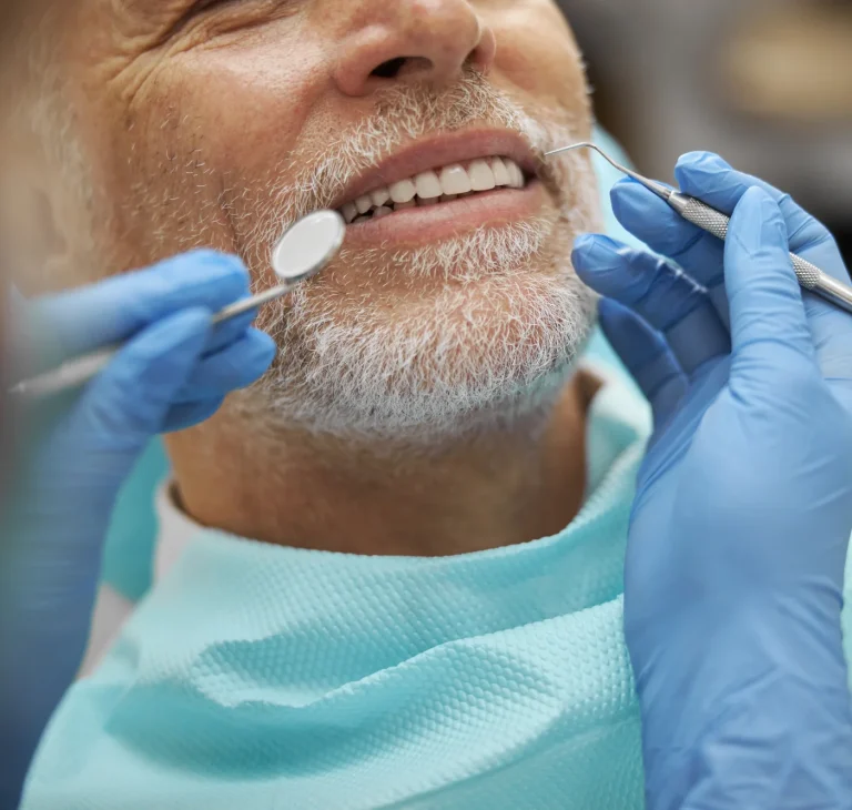 Full mouth reconstruction consultation