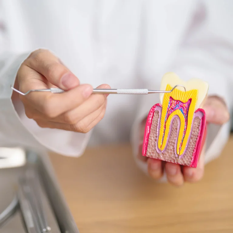 Root canal tooth model