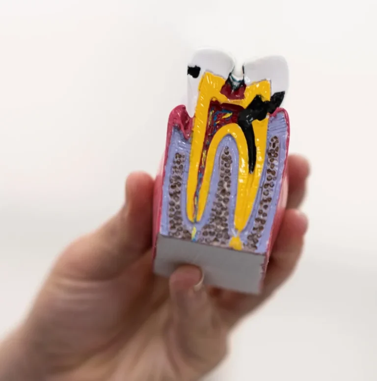 Tooth root canal anatomy