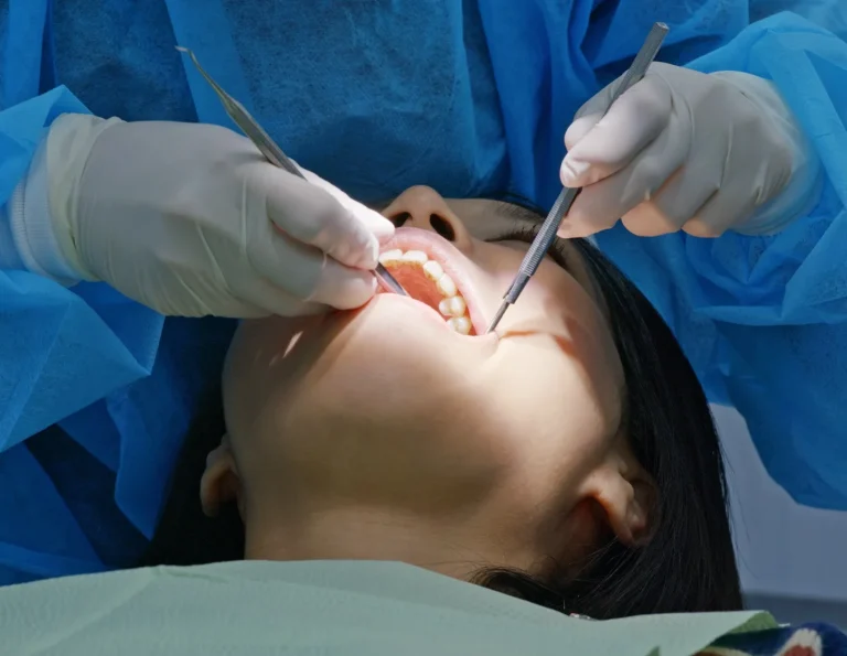 Oral surgeon removing wisdom tooth