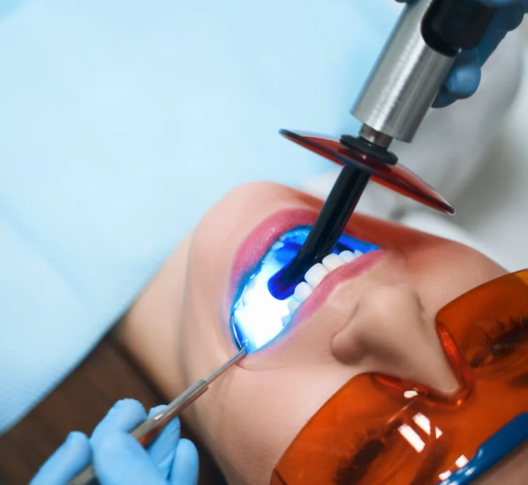 Dental bonding procedure treatment