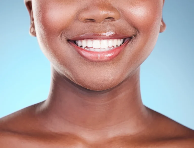 Professional teeth whitening results